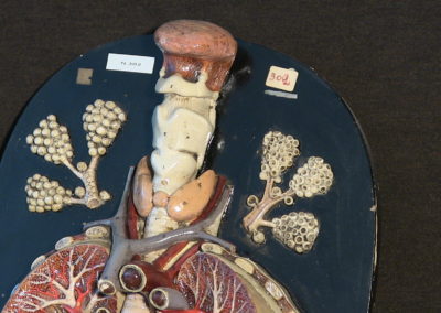 Modello di trachea e polmoni (particolare)