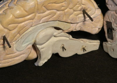 modello del cervello (sezione longitudinale a livello della scissura centrale, particolari)