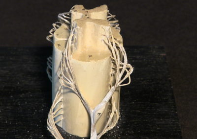 Modello del midollo spinale, 2