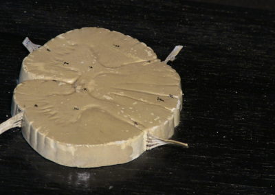 Modello del midollo spinale sezione).