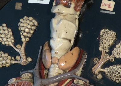 Modello di trachea e polmoni (particolare), 2
